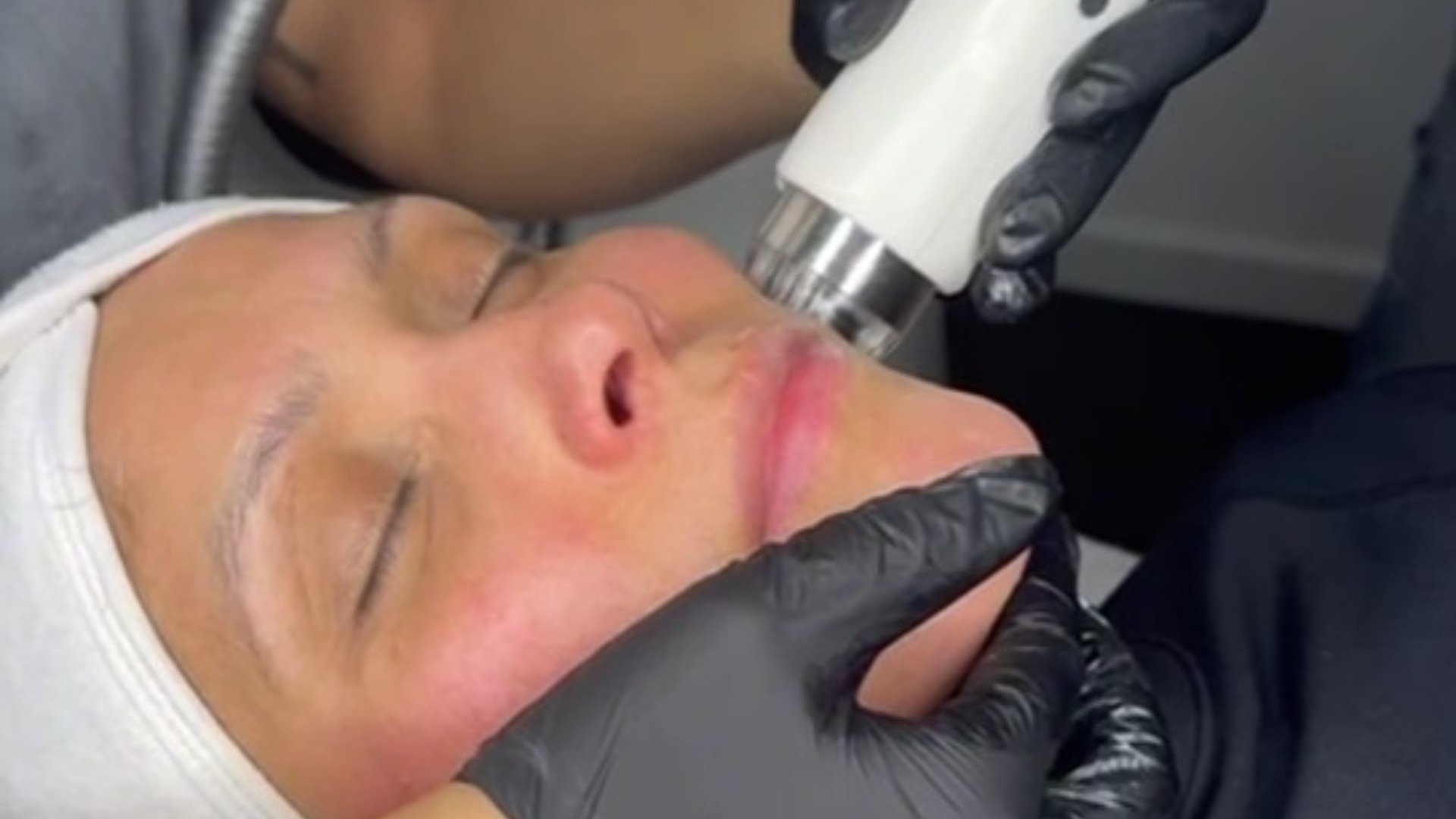 Jordi Shape Facial Rejuvenation at Athira Spa Altrincham