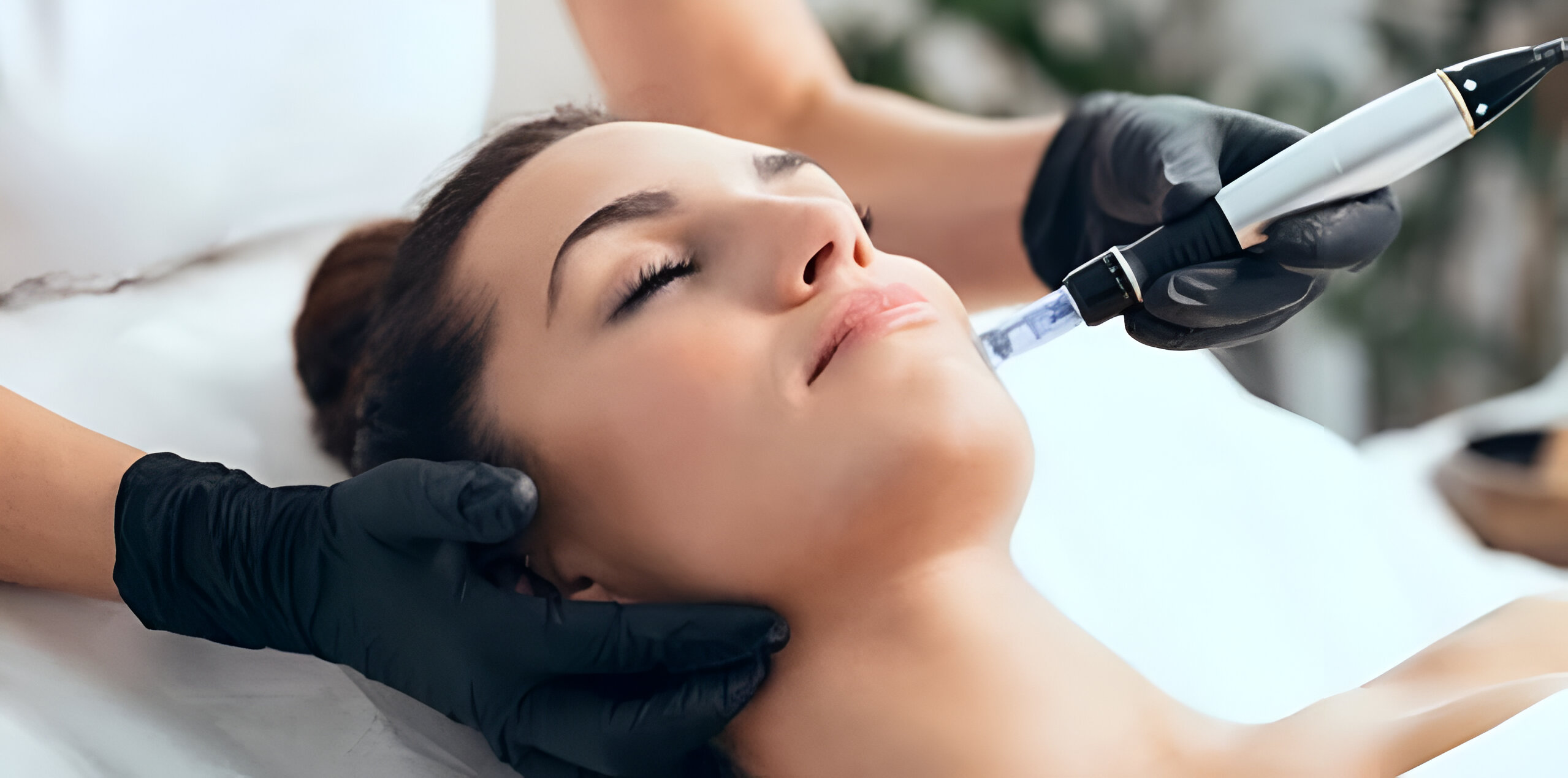 Expert performing Microneedling Altrincham treatment at Athira Spa.