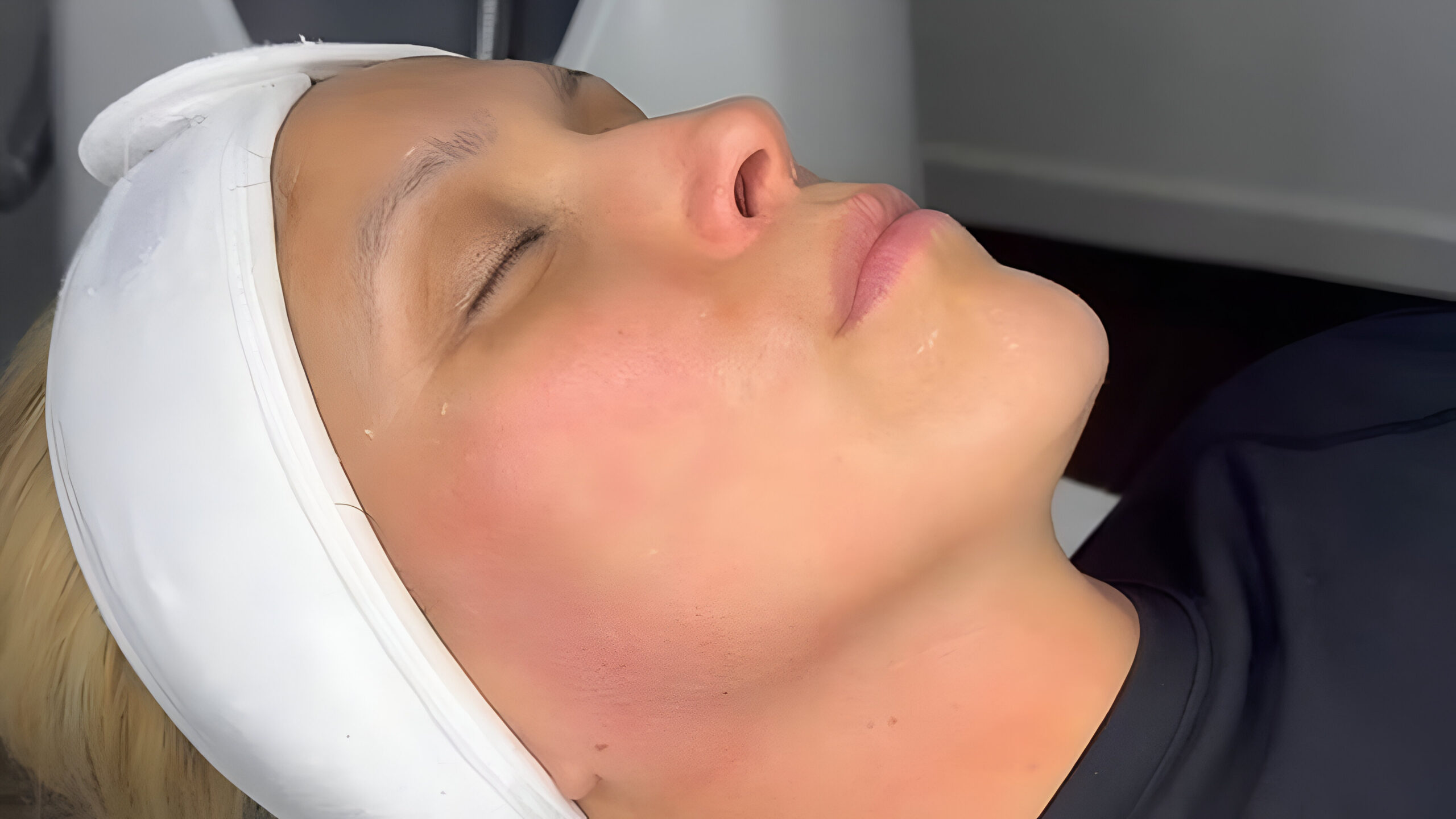 Comprehensive Guide to Facial Treatments at Athira Spa & Clinic in Altrincham